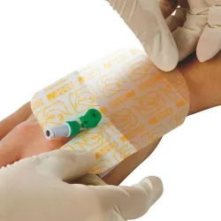 Opsite IV 3000 Smith & Nephew 6 x 7 cm één hand applicatie